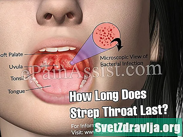 Как долго контагиозно воспаление горла?