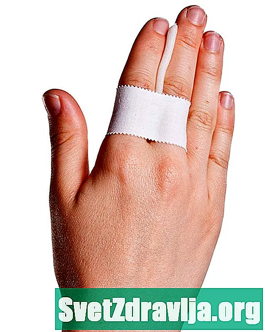 Kuidas lindistada sõrmi ja varbaid - Tervis