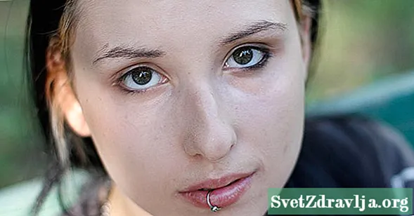 Ako identifikovať a liečiť infikovaný piercing do pier - Wellness