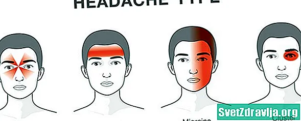 Sådan genkendes migrætsmerter hos teenagere - Sundhed