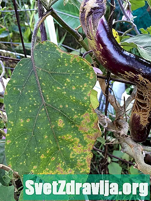 Paano Makibalita at Ituring ang isang Pimple na Puno ng Dugo - Kalusugan