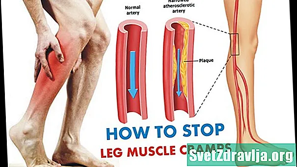 Kako ustaviti mišične krče nog
