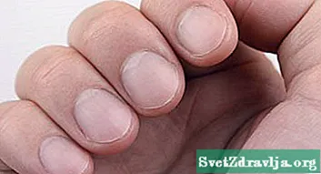 Quam ut tracta est INVETERATUS Fingernail