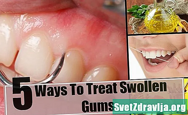 腫れた歯茎を中括弧で治療する方法