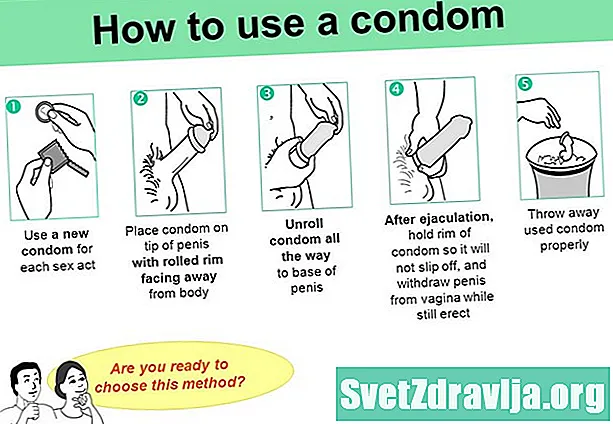 Si të përdorni prezervativët me siguri - Shëndetësor