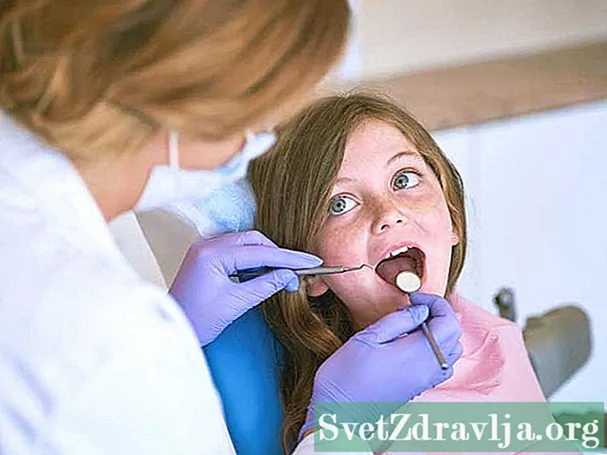 Hyperdontia: Musím si nechat odstranit zuby navíc?