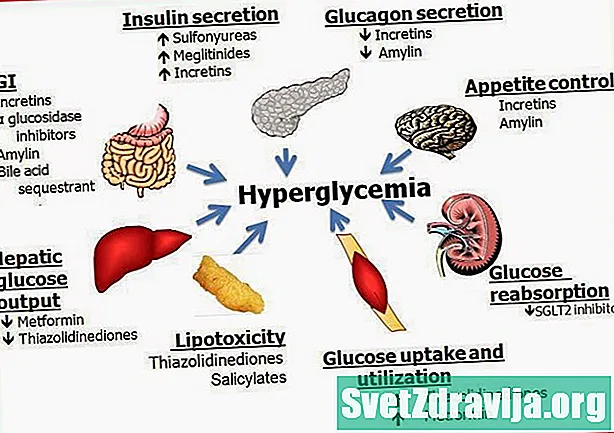 Hyperglykémie a diabetes 2. typu