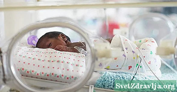 Inkubator untuk Bayi: Mengapa Mereka Digunakan dan Bagaimana Ia Berfungsi