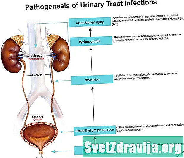 Infeccions en l'embaràs: uretritis aguda