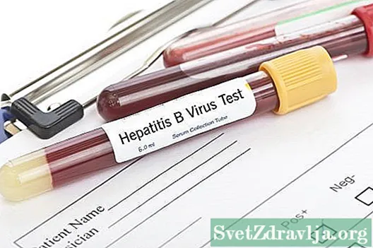 ကိုယ်ဝန်ရှိသည့်ရောဂါများ - Hepatitis A - ကျန်းမာရေး