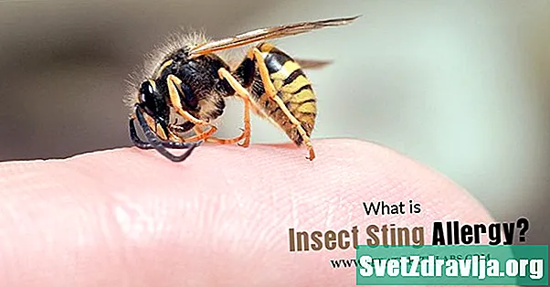 Tests d'allergie aux piqûres d'insectes