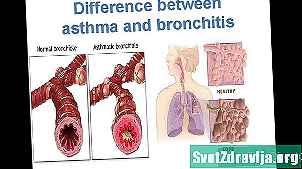 Astma och lunginflammation: Vad är skillnaderna?