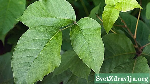 Ingabe yi-Psoriasis noma i-Poison Ivy? Ukukhomba, Ukwelashwa, nokuningi