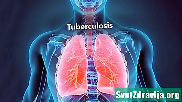 Ass Tuberkulos ustiechend a wéi ass et verbreet? - Gesondheet
