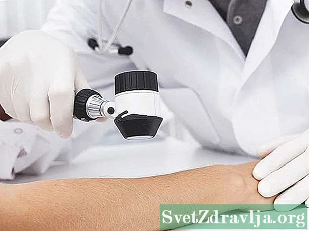 Wird Ihr Hautausschlag durch Hepatitis C verursacht?