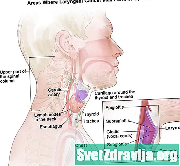 Laryngektómia: Účel, postup a zotavenie - Zdravie
