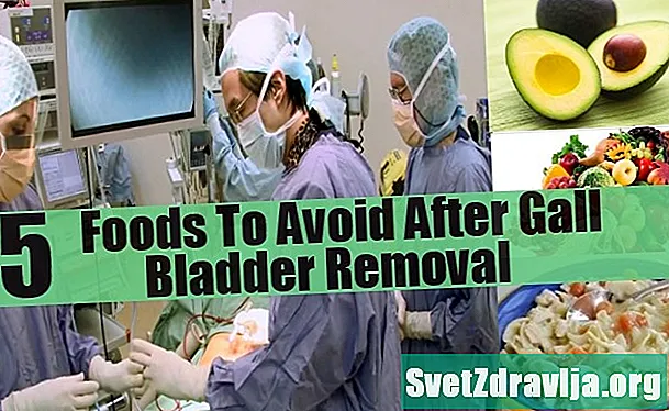 Buhay Pagkatapos ng Gallbladder Pag-alis ng Surgery: Mga Epekto ng Side at komplikasyon