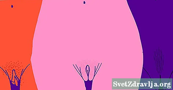 Lopsided vagina: Jesu li moje usne normalne?