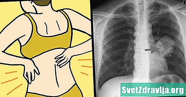 Lungekræft Symptomer hos kvinder - Sundhed