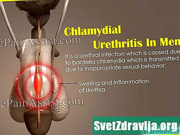Mannelijke chlamydiale urethritis - Gezondheid