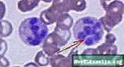 Megaloblastaire anemie