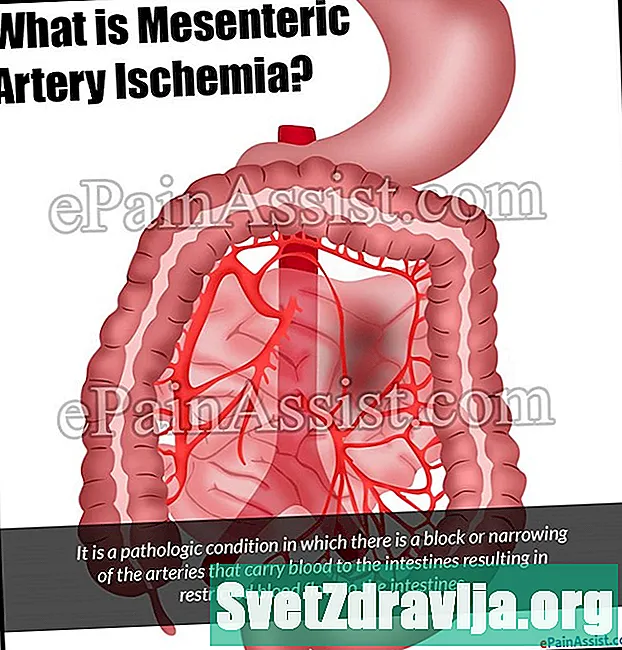 Ishemija mezenterične arterije