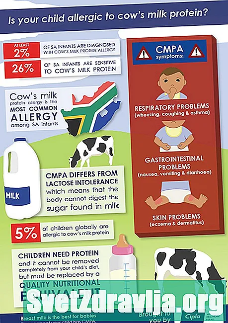 Alergija na proteine ​​mlijeka: Koje su mogućnosti moje formule?