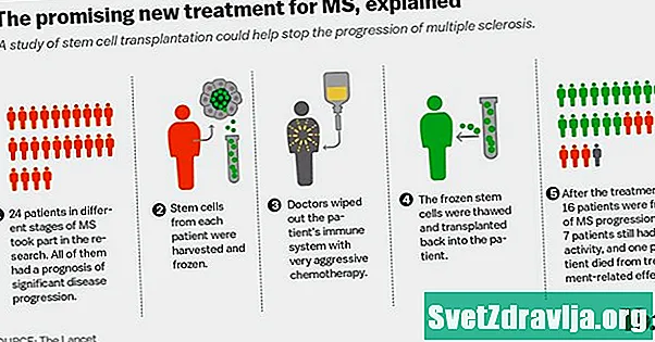 Szklerózis multiplex (MS) kezelések - Egészség