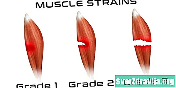 Souches musculaires