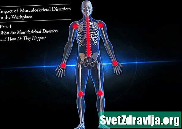 Skeleta-muskuļu sistēmas slimības