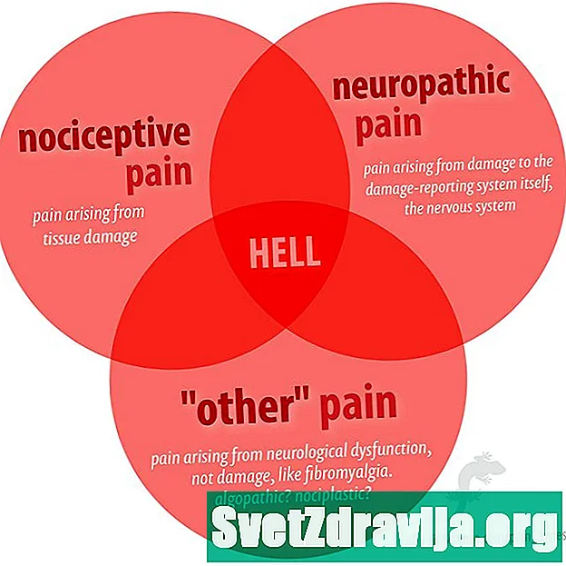 Nociceptivní bolest - Zdraví