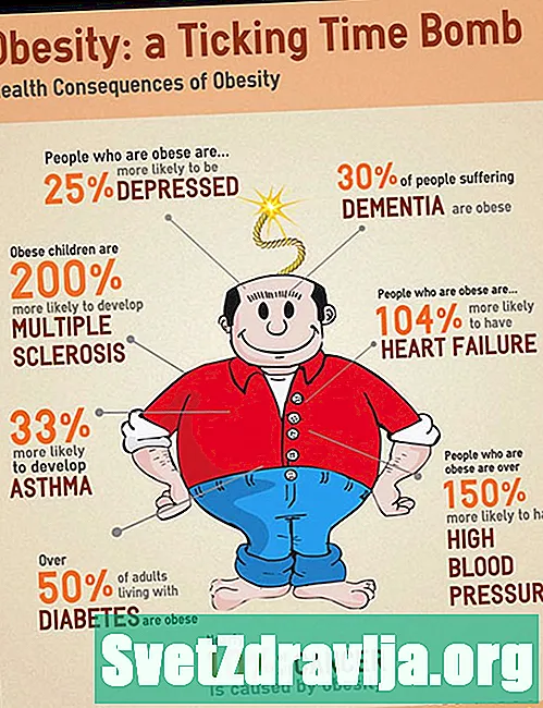 Факти за затлъстяване