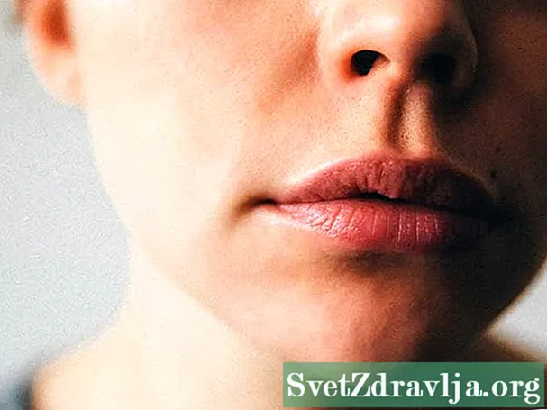 Mga oral STD: Unsa ang mga Sintomas?