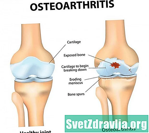 Osteoartrit bo'yicha dorilar ro'yxati
