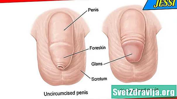 Penile Adhesions