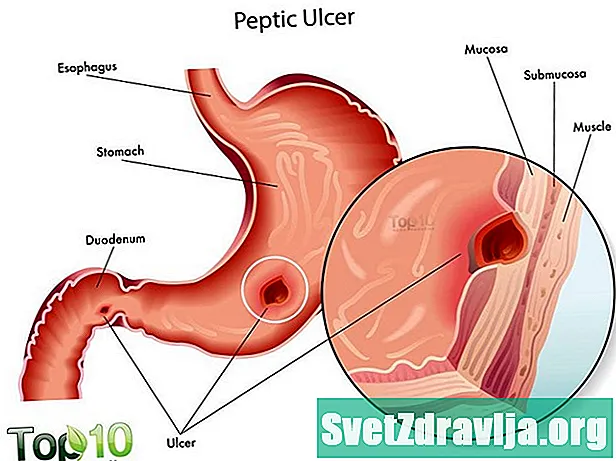 Ulcer Peipteach - Sláinte