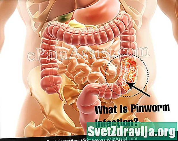 Pinworm fertőzés - Egészség