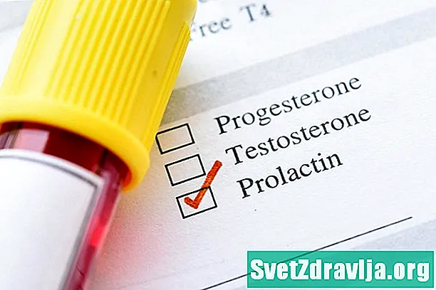Teste de nível de prolactina