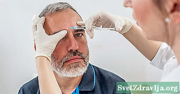 Dozimi i duhur për trajtimin e botoksit në ballë, sy dhe glabella