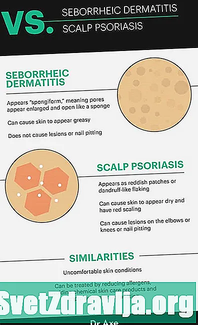 Psoriasis vs Seborrheic Dermatitis: Wat Dir Wësse sollt - Gesondheet
