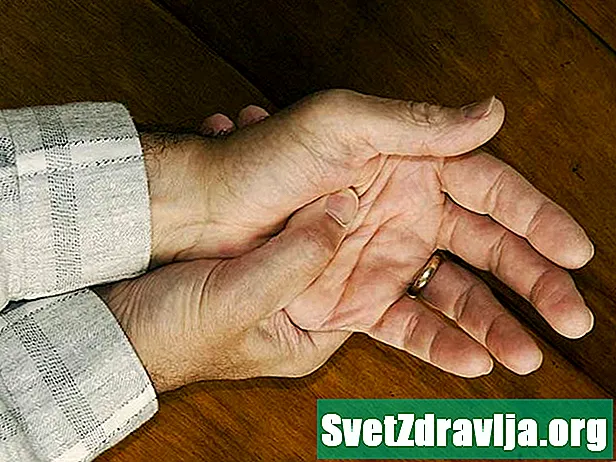 Mutilans psoriatickej artritídy: príznaky, liečba a ďalšie - Zdravie