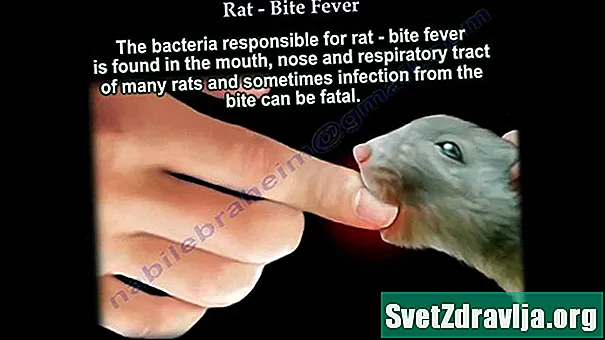 Primeros auxilios de mordedura de rata
