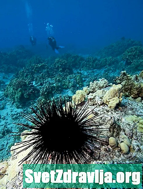 Erkänna och behandla Sea Urchin Stings - Hälsa