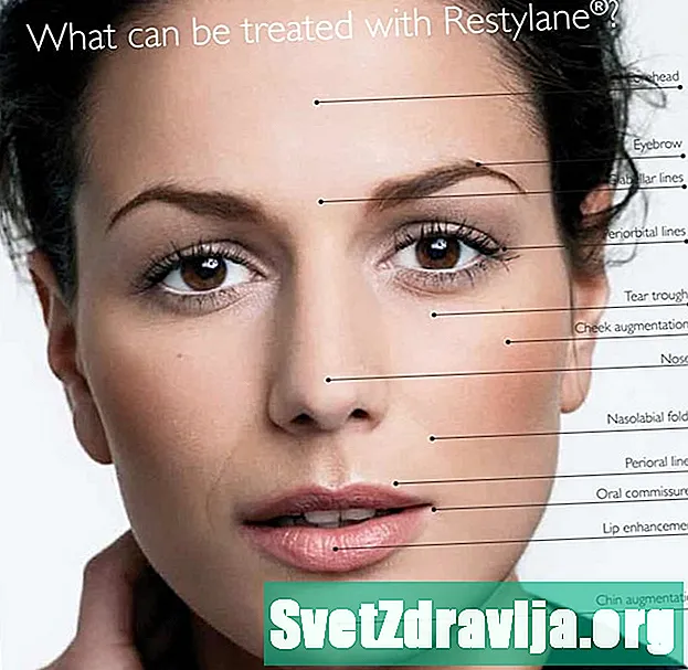 Restylane a Botox Fillers: Jaký je rozdíl?