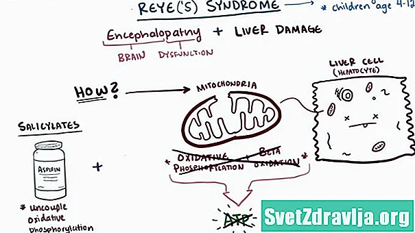 Reye sündroom - Tervis