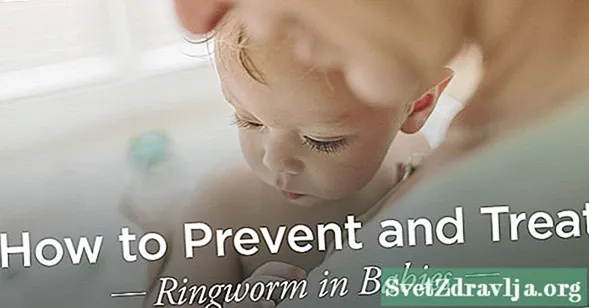 Ringworm dina Orok: Diagnosis, Perawatan, sareng Pencegahan