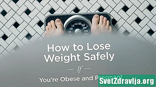 Turvallinen laihtuminen vinkkejä liikalihavuuteen - Terveys