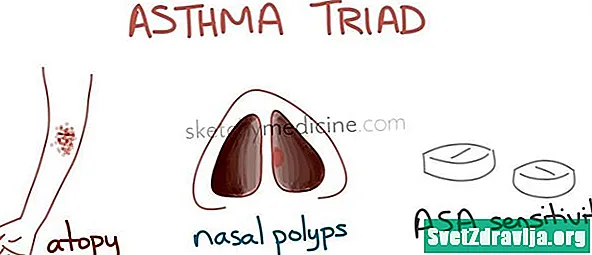 Самтердин триадасы: астма, мурундун полиптери жана Аспириндин сезгичтиги