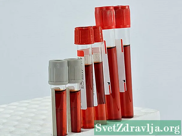 သွေးရည်ကြည် Herpes Simplex ပibိစမ်းသပ် - ကျန်းမာရေး