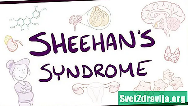 Šeihana sindroms - Veselība